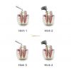 Endo Solution 50ml (EDTA 17%) Endo Solution 50ml (EDTA 17%)