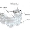 Trainer EF Orthoplus EF GUIDE (11-15 tuổi) Trainer EF Orthoplus EF GUIDE (11-15 tuổi)