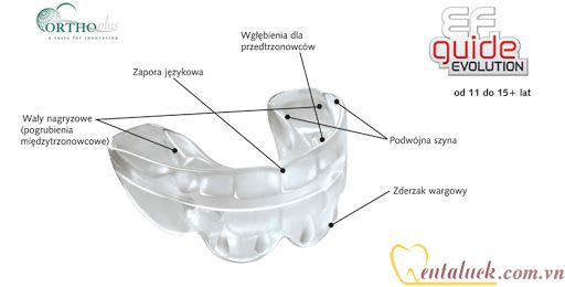Trainer EF Orthoplus EF GUIDE (11-15 tuổi) Trainer EF Orthoplus EF GUIDE (11-15 tuổi)